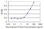 CPT2 Antibody in ELISA (ELISA)