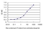 CPT2 Antibody in ELISA (ELISA)