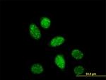 CREB1 Antibody in Immunocytochemistry (ICC/IF)