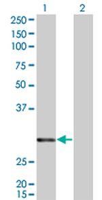 ATF2 Antibody in Western Blot (WB)