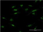 ATF2 Antibody in Immunocytochemistry (ICC/IF)