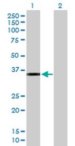 CRHBP Antibody in Western Blot (WB)