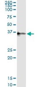 CRHBP Antibody in Immunoprecipitation (IP)