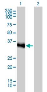 CRX Antibody in Western Blot (WB)