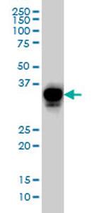 CRX Antibody in Western Blot (WB)