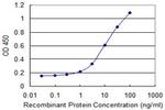 CRYBA4 Antibody in ELISA (ELISA)