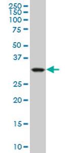 CRYM Antibody in Western Blot (WB)