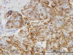 MAPK14 Antibody in Immunohistochemistry (Paraffin) (IHC (P))