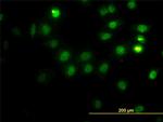 CSE1L Antibody in Immunocytochemistry (ICC/IF)