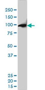 CSE1L Antibody in Western Blot (WB)