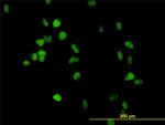 CSE1L Antibody in Immunocytochemistry (ICC/IF)