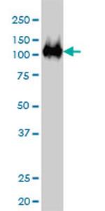 CSE1L Antibody in Western Blot (WB)