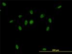 CSE1L Antibody in Immunocytochemistry (ICC/IF)