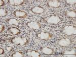 CSE1L Antibody in Immunohistochemistry (Paraffin) (IHC (P))