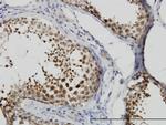 CSE1L Antibody in Immunohistochemistry (Paraffin) (IHC (P))