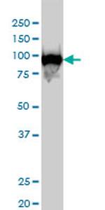 CSE1L Antibody in Western Blot (WB)