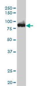 CSE1L Antibody in Western Blot (WB)