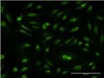 CSE1L Antibody in Immunocytochemistry (ICC/IF)