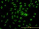 CSE1L Antibody in Immunocytochemistry (ICC/IF)