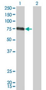 CSF1 Antibody in Western Blot (WB)