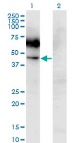 CSF2RA Antibody in Western Blot (WB)