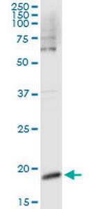 CSF3 Antibody in Immunoprecipitation (IP)