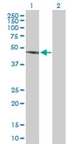 CSK Antibody in Western Blot (WB)