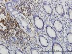 CSK Antibody in Immunohistochemistry (Paraffin) (IHC (P))