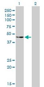 CSK Antibody in Western Blot (WB)