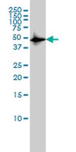 CSK Antibody in Western Blot (WB)