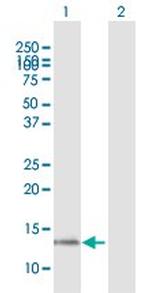 CST1 Antibody in Western Blot (WB)