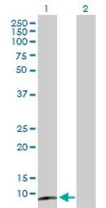 CST5 Antibody in Western Blot (WB)