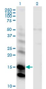 CST6 Antibody in Western Blot (WB)