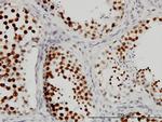 CSTF3 Antibody in Immunohistochemistry (Paraffin) (IHC (P))