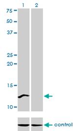 CSTF3 Antibody in Western Blot (WB)