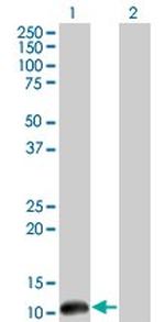 CSTF3 Antibody in Western Blot (WB)