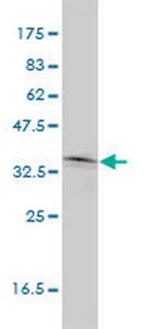 NKX2-5 Antibody in Western Blot (WB)