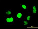 CTBP1 Antibody in Immunocytochemistry (ICC/IF)