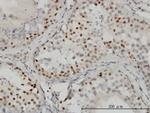 CTBP1 Antibody in Immunohistochemistry (Paraffin) (IHC (P))