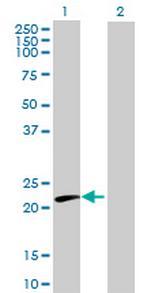 CTF1 Antibody in Western Blot (WB)