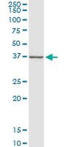 CTGF Antibody in Western Blot (WB)