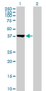 CTH Antibody in Western Blot (WB)