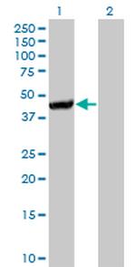 CTH Antibody in Western Blot (WB)