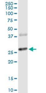 CTLA4 Antibody in Western Blot (WB)