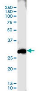 CTLA4 Antibody in Western Blot (WB)