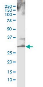 CTLA4 Antibody in Western Blot (WB)
