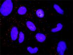 CTNNA1 Antibody in Proximity Ligation Assay (PLA) (PLA)