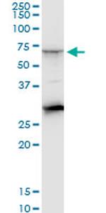 CTNS Antibody in Western Blot (WB)