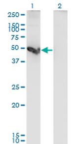 CTSE Antibody in Western Blot (WB)