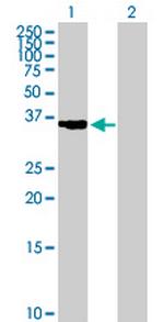 CTSK Antibody in Western Blot (WB)